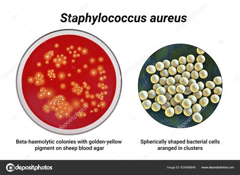 Blood Agar Staph Aureus