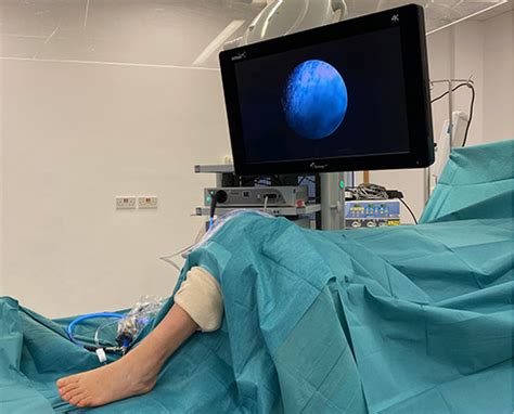 Ankle Arthroscopy Hertfordshire | Minimally Invasive Surgery | Ankle Surgeon High Wycombe