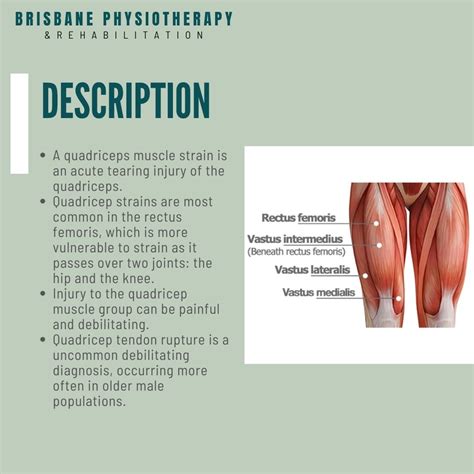 Quadriceps Muscle Tear Treatment at Rachel Vance blog