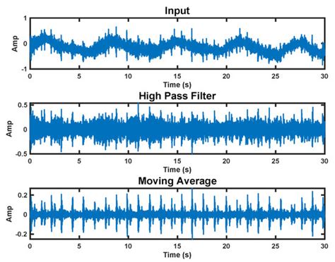 Bioengineering | Special Issue : Contactless Technologies for Human ...