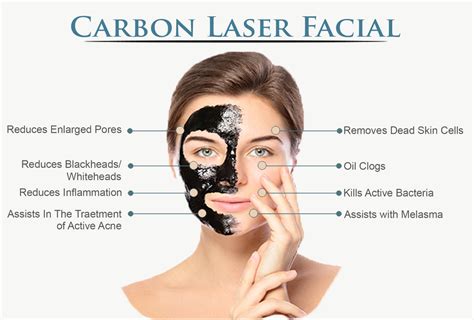 Hollywood Peeling Facial with Carbon Laser - Hannah Spa