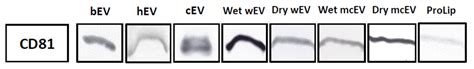 Milk-Derived Extracellular Vesicles Suppress Inflammatory Cytokine ...