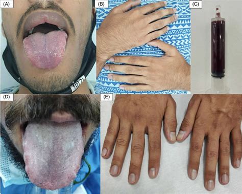 Image result for Examples of Patterns in Digital Image Processing