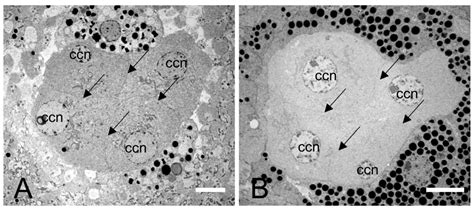 Comparison of Fine Structure of the Compound Eyes in Eucryptorrhynchus ...
