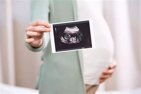 孕期“大排畸”检查是什么？