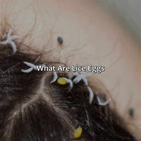 Can Lice Eggs Hatch In Carpet at Gene Courtney blog