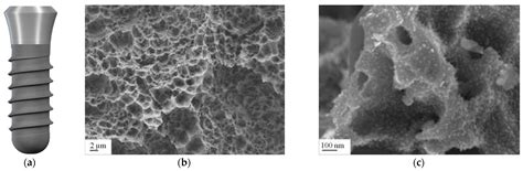 Developments in Dental Implant Surface Modification