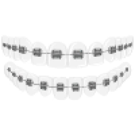 Does Medicaid Pay For Braces? Ultimate Guide For Free Braces