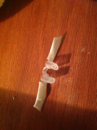 Surgery yesterday and Nose stents won't stay in! | BabyCenter