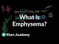 NDLI: What is emphysema?