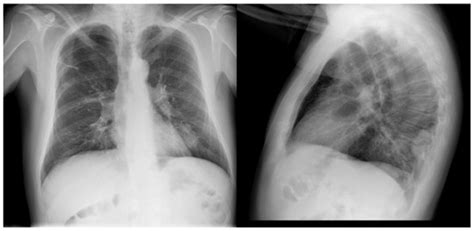 Current Oncology | November 2024 - Browse Articles