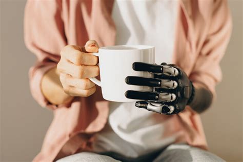 Image result for Bionic Arm Prosthetics