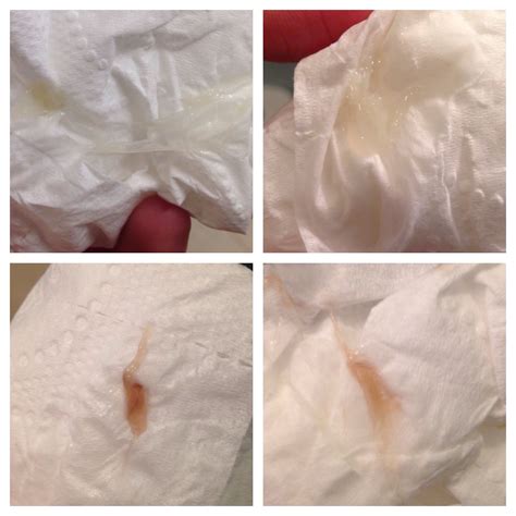 Mucus After Implantation