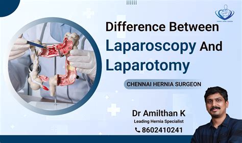Difference between Laparoscopy and Laparotomy - chennaiherniasurgeon