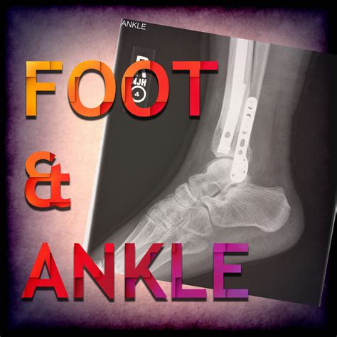 Foot 的图像结果