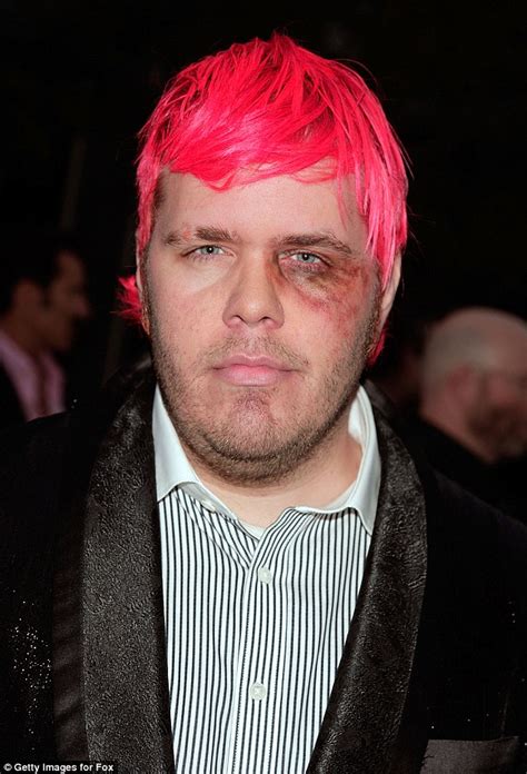 Bildergebnis für politicians and celebrities with black eyes