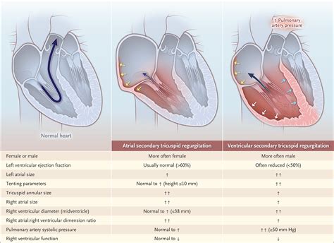 Pacemaker And Ultrasonic Contraindications at Sophia Wiseman blog