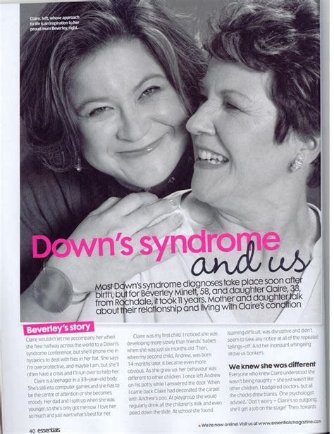 Celebrities with mosaic down syndrome - constructionfity