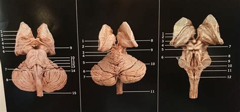 Brain 的图像结果