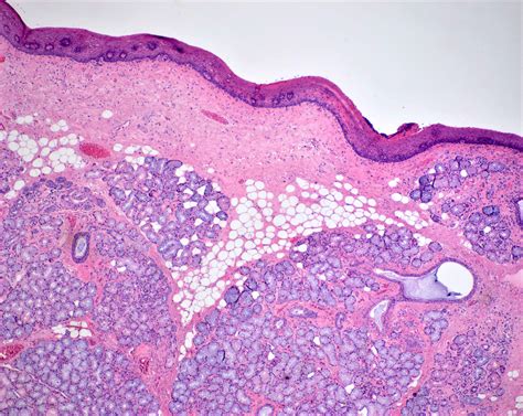 Parotid Histology