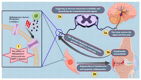 TRPV Channels in Osteoarthritis: A Comprehensive Review