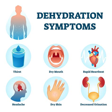 Dehydration symptoms vector illustration. Water deficit diagnosis scheme. - AEC Living