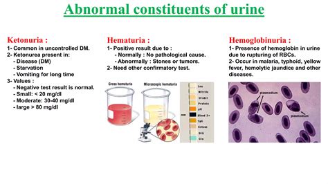 Biochemistry (urine analysis normal and abnormal urine constituents) | PDF
