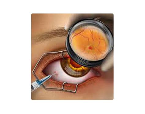 Image result for IVT Injection