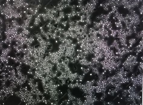 Budding Yeast In Urine