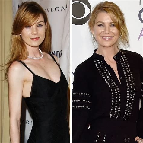 Ellen Pompeo Plastic Surgery Face
