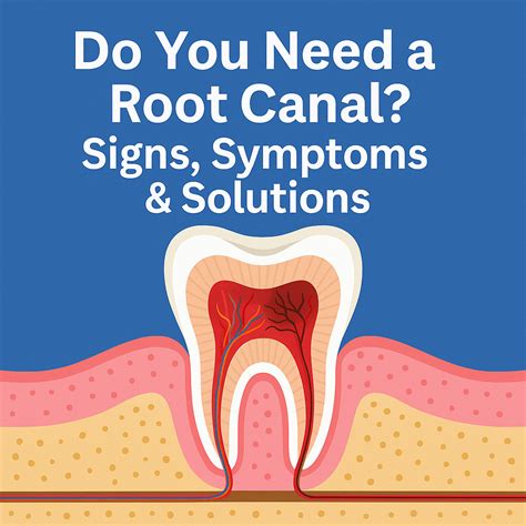 Do You Need a Root Canal in Woodland Hills?