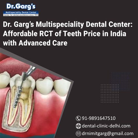 Affordable RCT Cost in Delhi | Dr. Garg’s Clinic
