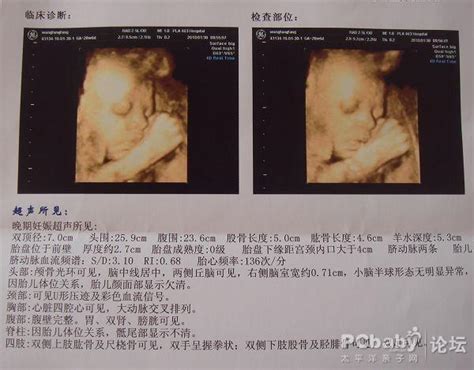 怀孕30周，四维彩超做了25分钟，对胎儿有影响吗？_百度宝宝知道-如何看胎儿四维彩超报告