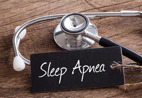 Image result for Sleep Apnea Example
