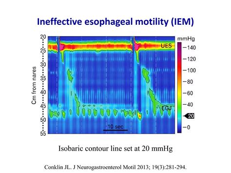 Esophageal motility disorders in Chicago classification v3.0 | PPTX