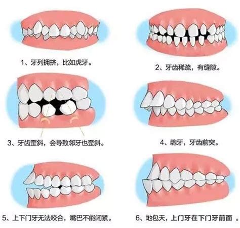 28颗牙齿排列图编号,28颗牙齿名称图片,28颗牙齿编号位置图_大山谷图库
