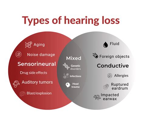 Sensorineural Hearing Loss Vs Conductive Hearing Loss