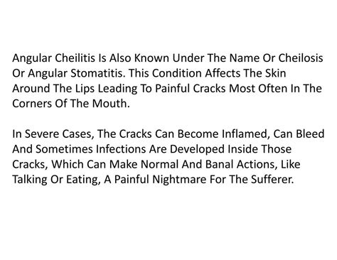 PPT - Cracks At Corner Of Mouth, Chelitis, Antifungal Cream For Angular Cheilitis, Treat Angular ...
