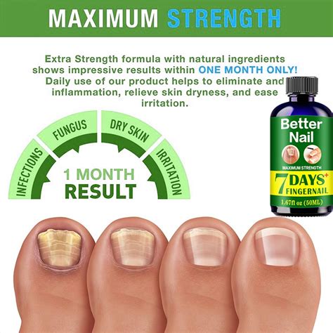 Nail Fungal Treatment Feet Care Essence Against Oils Fungus Removal Gel ...