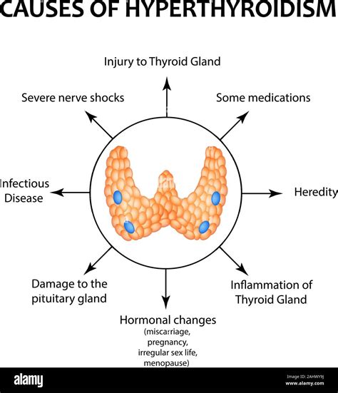 What Triggers Hyperthyroidism