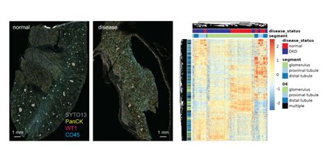 NanoString Spatial Transcriptomics 的图像结果
