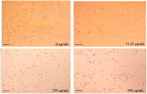 Chemical Profiling, Antioxidant, Antiproliferative, and Antibacterial ...