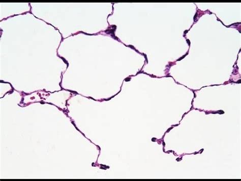 Histology - Connective Tissue - Tissues, Science Video Lecture - Class 9