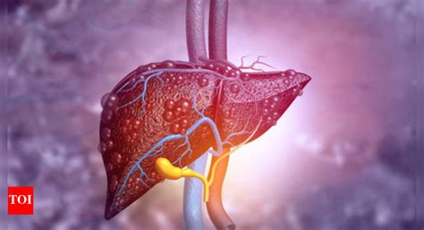 Hepatitis prevention: A guide to stay safe from Hepatitis B and C ...