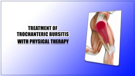 Hip Trochanteric Bursitis Exercises Illustration