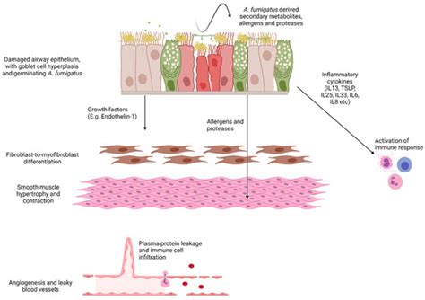 Aspergillus fumigatus—Host Interactions Mediating Airway Wall ...