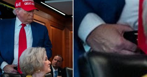 "Superstitious" Trump says higher aspirin dosage behind hand bruises