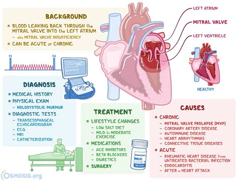 Mitral valve insufficiency - causes, symptoms, treatment - Healthy Food ...