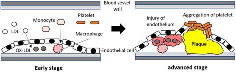 Pathological Significance of Macrophages in Erectile Dysfunction ...