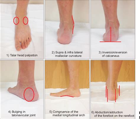 [PDF] Correlation of Foot Posture Index With Plantar Pressure and Radiographic Measurements in ...
